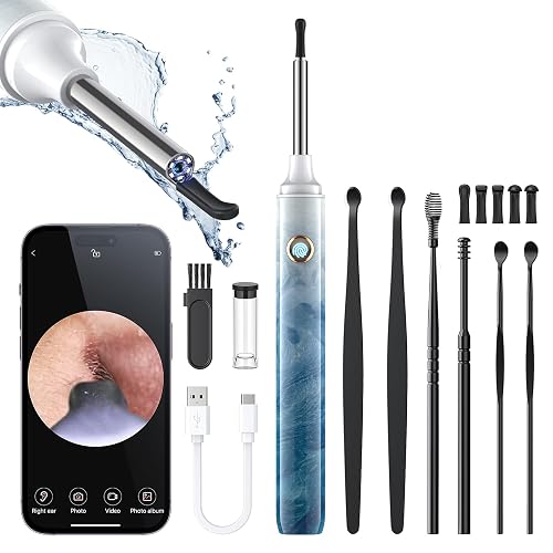 Ear Wax Removal Tool Camera - Ear Cleaner with 1080P HD Camera, Otoscope with Light, Earwax Removal Kit for iPhone, iPad, Android Phones (Ice Blue)